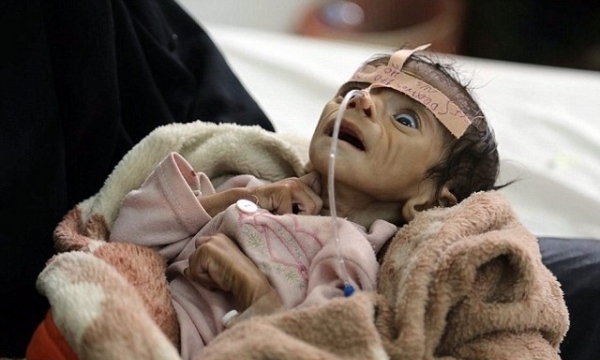 Bức ảnh em bé chết khô vì đói khát khiến nhiều người xúc động